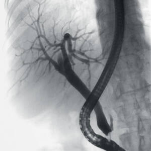 ci-ercp-ziehmvisionrfd-cmosline