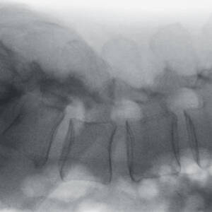 ci_cervicalspine_magmode0_ziehmvisionfd_cmos