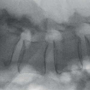 ci_cervicalspine_magmode1_ziehmvisionfd_cmos
