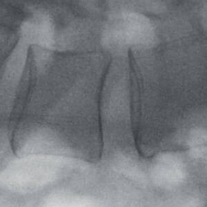 ci_cervicalspine_magmode2_ziehmvisionfd_cmos