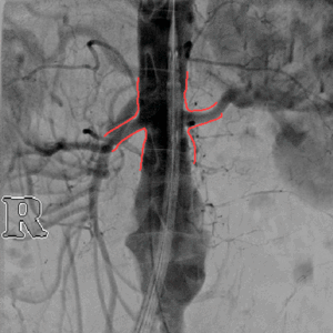 clinical_image_amt_stylus_de