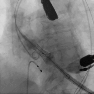 clinical_image_cineloop_1_2