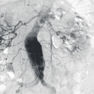 clinical_image_co2