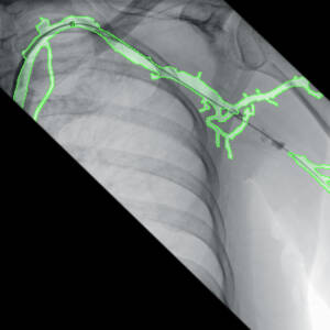 clinical_image_evv