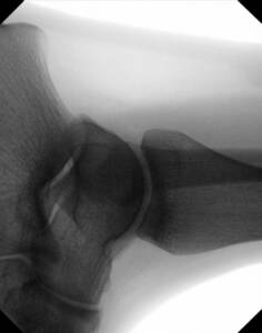 mobile-di-clinical-image-ankle-lateral_web
