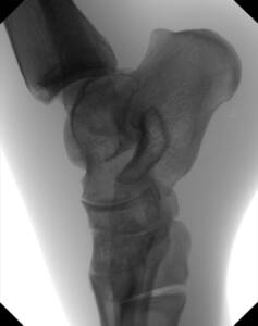 tau-1512-clinical-image-ankle-lateral_web