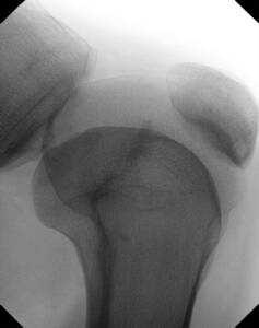tau-1512-clinical-image-knee-lateral_web