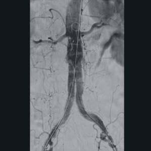 zie-3074-x-ray-00000296_pvdr4_ii_srgb_forscreensonly