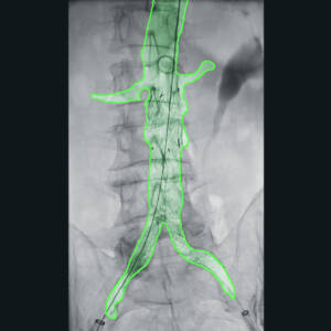 zie-3074-x-ray-00000298_pvdr6_srgb_forscreensonly