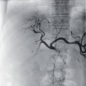 zie-3074-x-ray-00001308_pvdr2_ii_srgb_forscreensonly