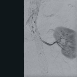 zie-3074-x-ray-00002333_pvdr4_ii_srgb_forscreensonly