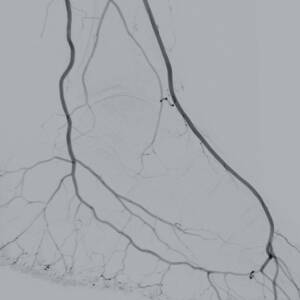 zie-3074-x-ray-00003625_pvdr_ii_srgb_forscreensonly