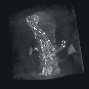 zie-3074-x-ray-00004481_pvdr4_ii_srgb_forscreensonly
