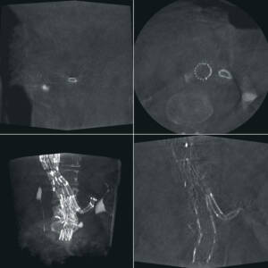 zie-3074-x-ray-00004484_pvdr4_ii_srgb_forscreensonly