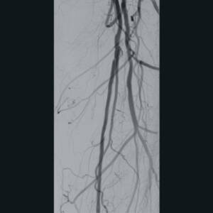 zie-3074-x-ray-00008253_pvdr3_ii_srgb_forscreensonly
