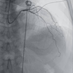 zie-3115-x-ray-00000153_pvdr6_ii_srgb_forscreenonly