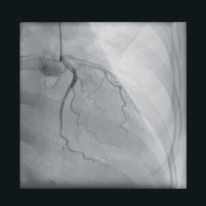 zie-3115-x-ray-00000461_pvdr6_ii_srgb_forscreenonly