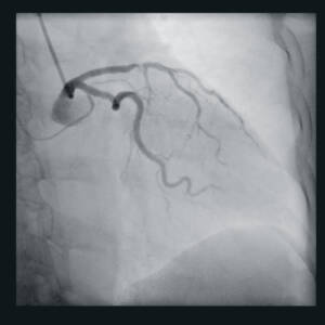 zie-3115-x-ray-00000527_pvdr5_ii_srgb_forscreenonly