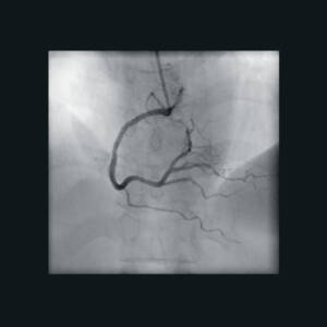 zie-3115-x-ray-00000529_pvdr5_ii_srgb_forscreenonly