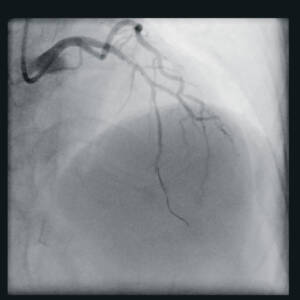 zie-3115-x-ray-00000530_pvdr5_ii_srgb_forscreenonly
