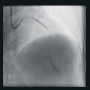 zie-3115-x-ray-00000531_pvdr5_ii_srgb_forscreenonly