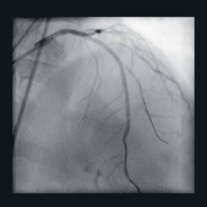 zie-3115-x-ray-00000983_pvdr5_ii_srgb_forscreenonly