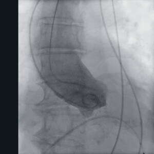 zie-3115-x-ray-2756_pvdr6_ii_srgb_forscreenonly