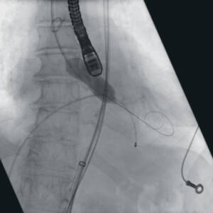 zie-3115-x-ray-2758_pvdr5_ii_srgb_forscreenonly