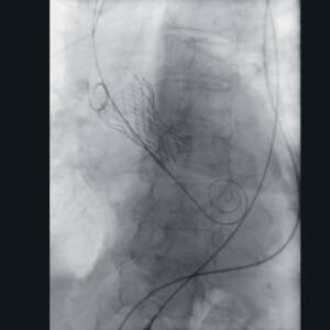 zie-3115-x-ray-2761_pvdr5_ii_srgb_forscreenonly