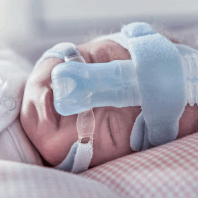 Solutions néonatales mobiles