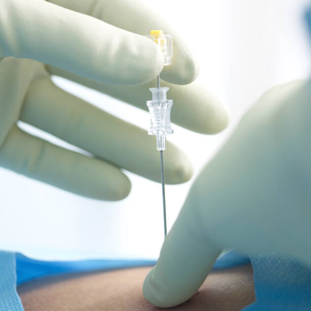 Solutions de radioprotection