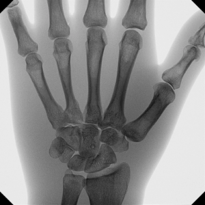 versa-clinical-image-hand-ap_web.1600x0